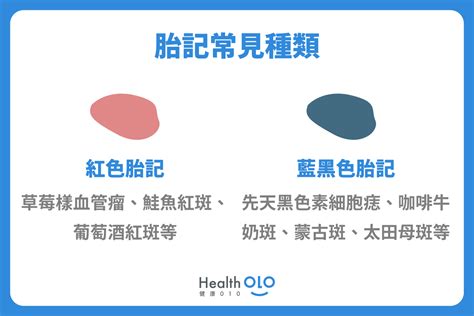 手臂上有胎記|胎記怎麼產生、何時消除？醫師剖析胎記種類、胎記寓意